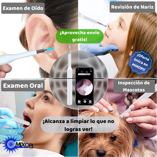 Otoscopio Limpiador de Oidos con Luz y Camara HD